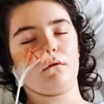 0 Teen who had 7lbs hairball removed after eating her own hair delighted as her locks grow back 1