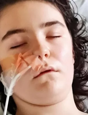 0 Teen who had 7lbs hairball removed after eating her own hair delighted as her locks grow back 1