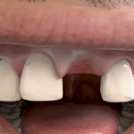 108711 thatviralfeed.com smallv2small 607128