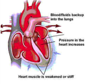 Young Mom Horrified After Doctors Reveal Her 'Heart Attack' Was Actually Oil Filling Her Lungs From Vaping 3 q8T7BYHjjVy5Qr8lf6MQWw